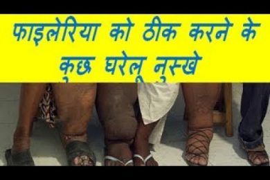 फाइलेरिया को ठीक करने के कुछ घरेलू नुस्खे HOME REMEDIES OF Filaria