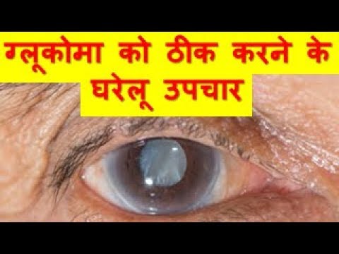 ग्लूकोमा को ठीक करने के घरेलू उपचार Home Remedies For Glaucoma