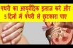 पथरी का आयुर्वेदिक इलाज करे और 5 दिनों में पथरी से छुटकारा पाए Ayurvedic Treatment Of Stones