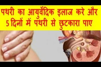 पथरी का आयुर्वेदिक इलाज करे और 5 दिनों में पथरी से छुटकारा पाए Ayurvedic Treatment Of Stones