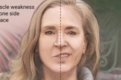 paralysis or lakwa treatment in hindi   लकवा ठीक करने के आयुर्वेदिक तरिके इन हिंदी