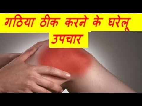 गठिया ठीक करने के घरेलू उपचार Natural Remedies for Arthritis