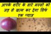 आपके शरीर के सारे मस्सो को जड़ से खत्म कर देगा सिर्फ एक प्याज