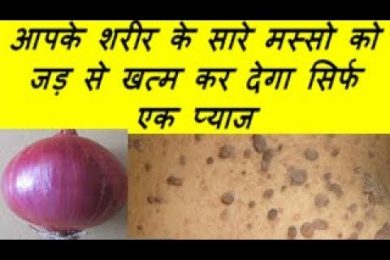 आपके शरीर के सारे मस्सो को जड़ से खत्म कर देगा सिर्फ एक प्याज