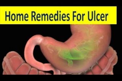 Home Remedies For Ulcer अलसर के कुछ घरेलू उपचार