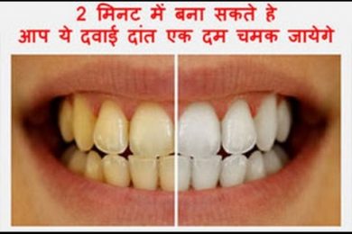 How To Whiten Your Yellow Teeth Naturally At Home in 2 minutes Tooth Whitening  Works 100%toothbrush