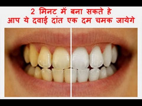 How To Whiten Your Yellow Teeth Naturally At Home in 2 minutes Tooth Whitening  Works 100%toothbrush