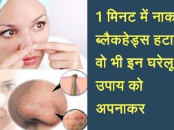 13 Natural Ways to Remove Blackheads | home remedies reduce Blackheads |