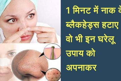 13 Natural Ways to Remove Blackheads | home remedies reduce Blackheads |
