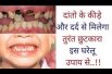 Home remedies for teeth इस घरेलू उपाय से दांतो के कीड़े और दर्द से मिलेगा तुरंत छुटकारा