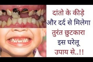 Home remedies for teeth इस घरेलू उपाय से दांतो के कीड़े और दर्द से मिलेगा तुरंत छुटकारा