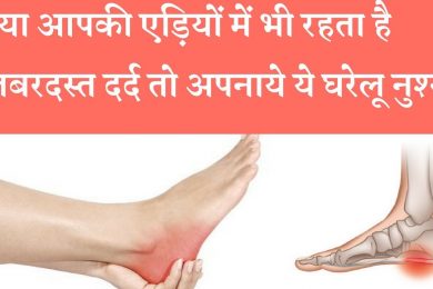 Home Remedy Treatments for Heel Pain क्या आपको भी चलने पर होता है एड़ियों में दर्द