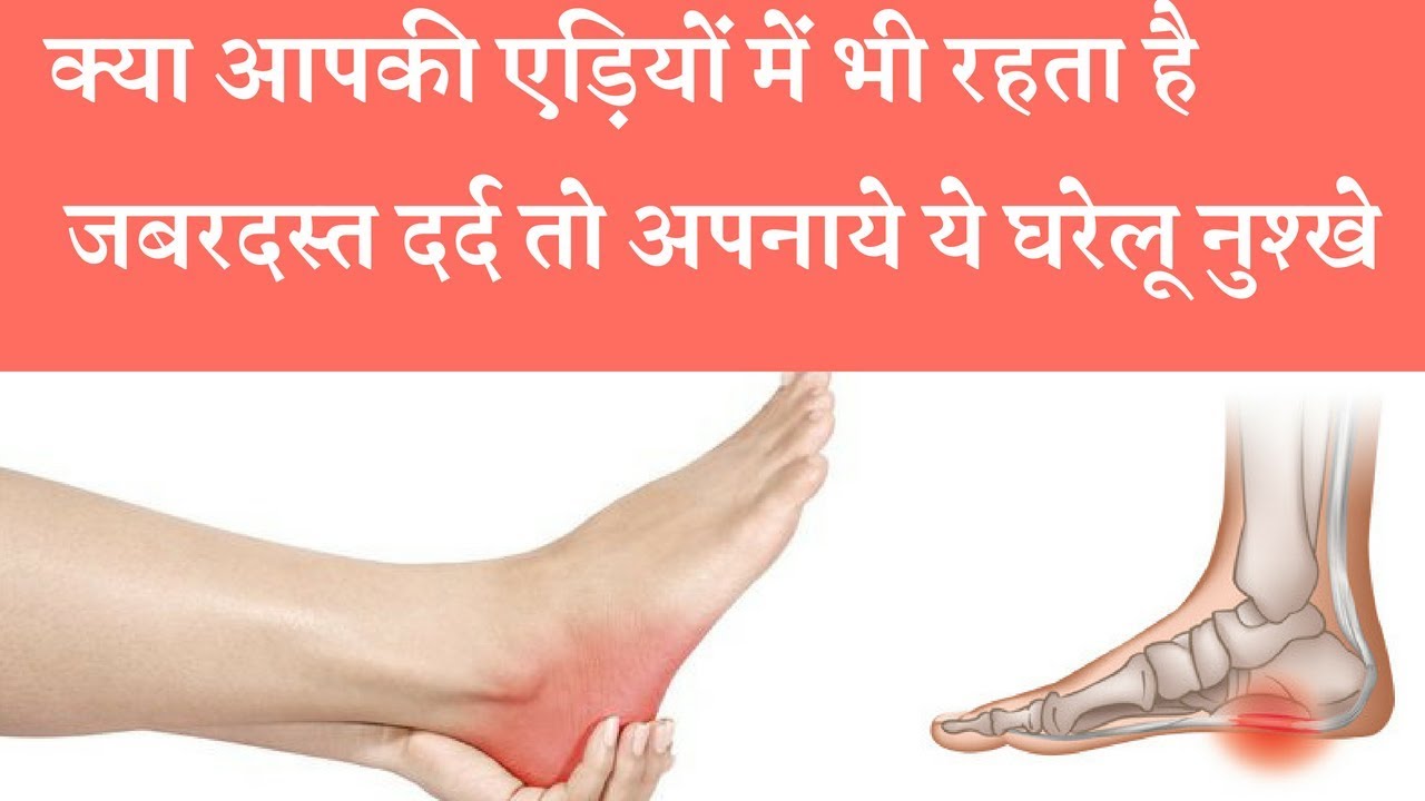 Home Remedy Treatments for Heel Pain क्या आपको भी चलने पर होता है एड़ियों में दर्द