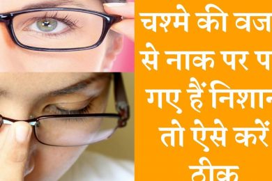 Home remedies to remove spectacle marks on nose  नाक पर भी पड़ है काले निशान तो अपनाये घरेलू उपायों