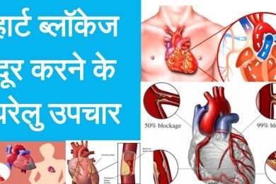 Home Remedy For Blockage In Heart – हार्ट ब्लॉकेज दूर करने के सबसे असरकारक घरेलु उपचार