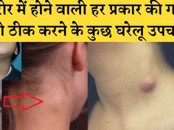 Some home remedies for fixing every kind of lump in the body शरीर में होने वाली हर प्रकार की गांठ के