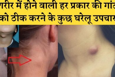 Some home remedies for fixing every kind of lump in the body शरीर में होने वाली हर प्रकार की गांठ के
