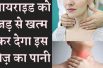 Thyroid natural cure home remedies is drinking coriander seed water