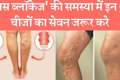 Take these things in the problem of vein blockage  नस ब्लॉकेज' की समस्या में इन चीज़ो का सेवन करे