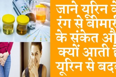 urine colour health problems | Why does urine stink
