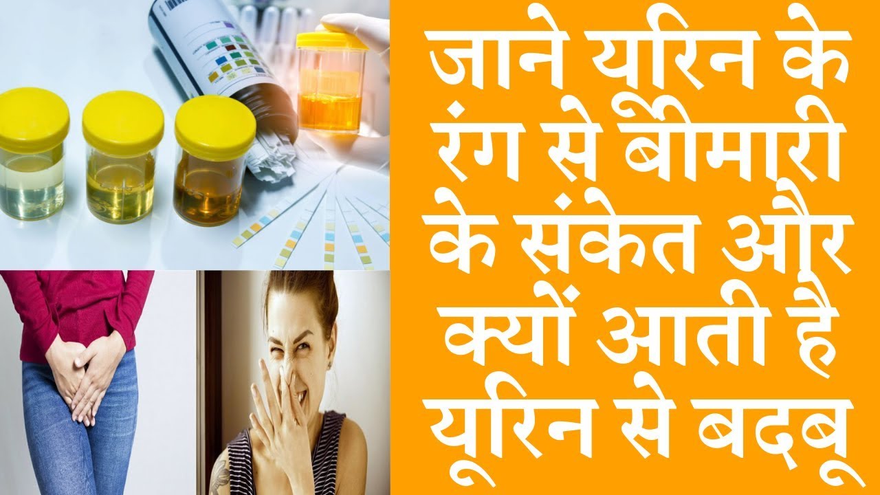 urine colour health problems | Why does urine stink