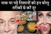 Home remedies to remove spectacle marks on nose | नाक पर पड़े निशानों से छुटकारा पाने के उपाय