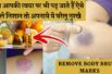 Best Home Remedies To Remove Body Bruise Marks | शरीर पर दिखे ऐसे नील के निशान, तो आप हो जाएं सावधान