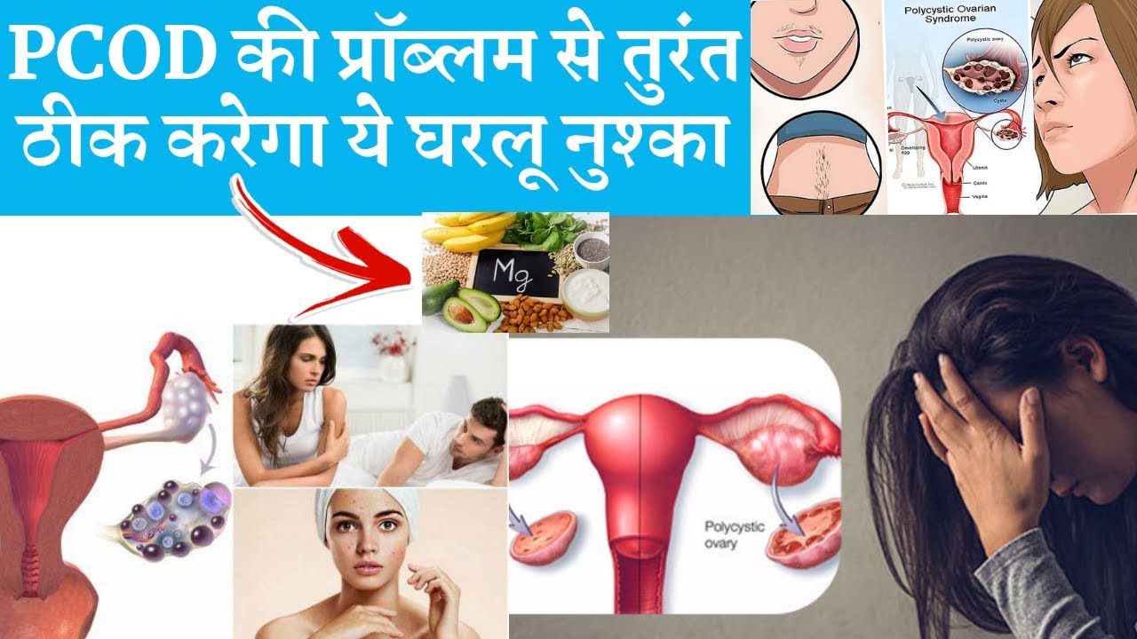 How to treat PCOD with Home Remedies |  PCOD के घरेलू उपाय
