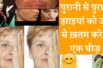 Get Rid Of Pigmentation, Dark Spots On Face | झाइयां दूर करने के सबसे असरदार घरेलू तरीका