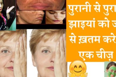 Get Rid Of Pigmentation, Dark Spots On Face | झाइयां दूर करने के सबसे असरदार घरेलू तरीका