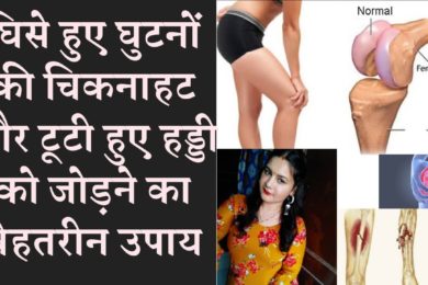 घिसे हुए घुटनों की चिकनाहट ,घुटने की टूटी हड्डी जोड़ने के लिए , ये चीज़ जरूर ले knee, bone treatment
