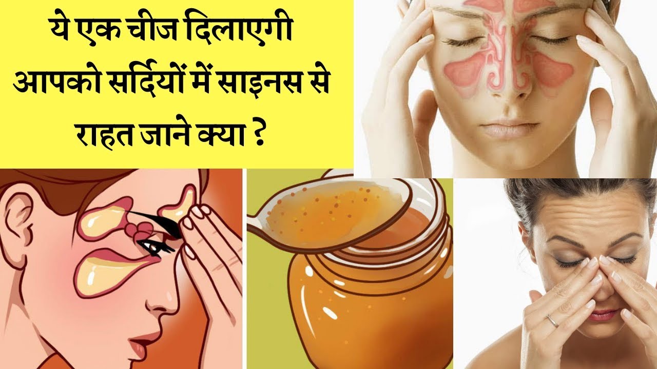 सर्दियों में साइनस से राहत दिलाएगी यह एक चीज ☝️☺️Best home remedies for sinus