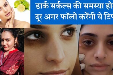 डार्क सर्कल्स की समस्या होगी दूर | Get rid of dark circles naturally