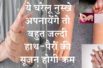 बहुत जल्दी हाथ पैरों की सूजन होगी कम अगर फॉलो करेंगे ये टिप्स ☝️Remedies to get relief from swelling