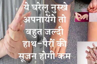 बहुत जल्दी हाथ पैरों की सूजन होगी कम अगर फॉलो करेंगे ये टिप्स ☝️Remedies to get relief from swelling