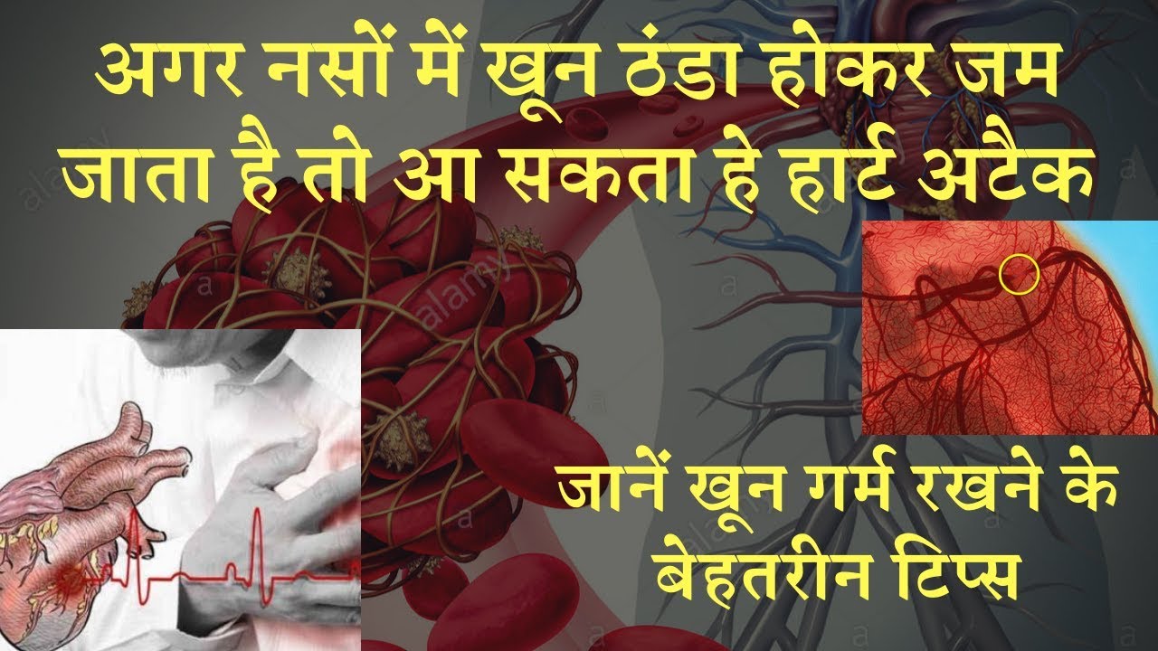 अगर नसों में खून ठंडा होकर जम जाता है तो आ सकता हे हार्ट अटैक? जानें खून गर्म रखने के बेहतरीन टिप्स