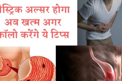 गैस्ट्रिक अल्सर से छुटकारा पाने के बेहतरीन नुस्खे जाने | Gestik alsar problem
