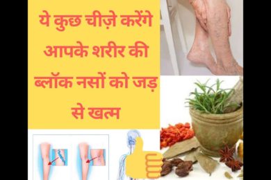 सर से पाँव तक की सारे ब्लाक नस होगा जड़ से खत्म जाने ? ??varicose veins treatments