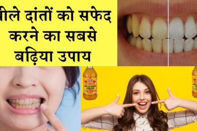 जाने दांतों का पीलापन हटाने का कारगर उपाय |  Removed the yellowing of teeth