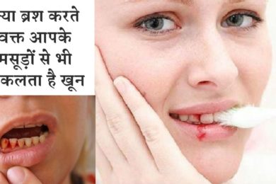 Home remedies to get relief from bleeding gums ? क्या आपके मसूड़ों से भी निकलता है खून