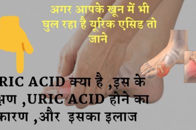 Reduce Uric Acid Levels,Herbal Gout Treatment  | यूरिक एसिड के लक्षण, कारण, इलाज, जाने