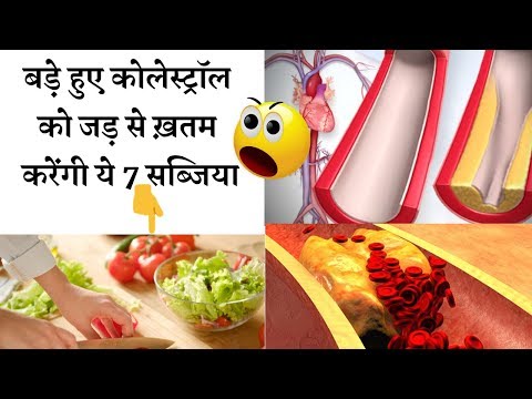 Cholesterol Treatment Artery Cleanse Remedy |  ये 7 सब्जी खाकर करे कोलेस्ट्रॉल को जड़ से ख़तम जाने