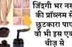 Veins Blockage Natural Treatment || नसों की प्रॉब्लम से छुटकारा पाए वो भी इस एक चीज़ से