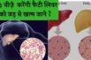 फैटी लिवर को खत्म करेंगी ये 3 चीज़े || Fatty liver disease