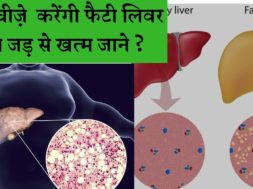 फैटी लिवर को खत्म करेंगी ये 3 चीज़े || Fatty liver disease