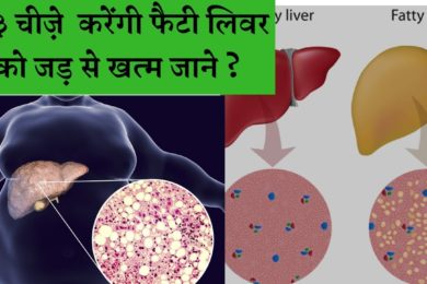 फैटी लिवर को खत्म करेंगी ये 3 चीज़े || Fatty liver disease
