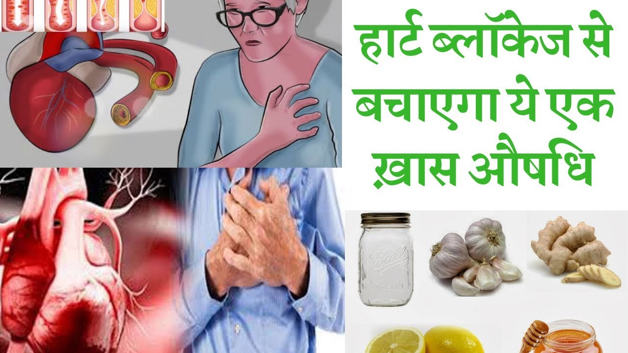 These home remedies to avoid heart blockage || आपका 1 काम नहीं होने देगा आपको  उम्रभर हार्ट ब्लॉकेज