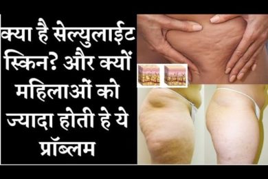 food that fights cellulite  सेल्युलाईट स्किन से बचने के लिए इन चीजों का सेवन करे