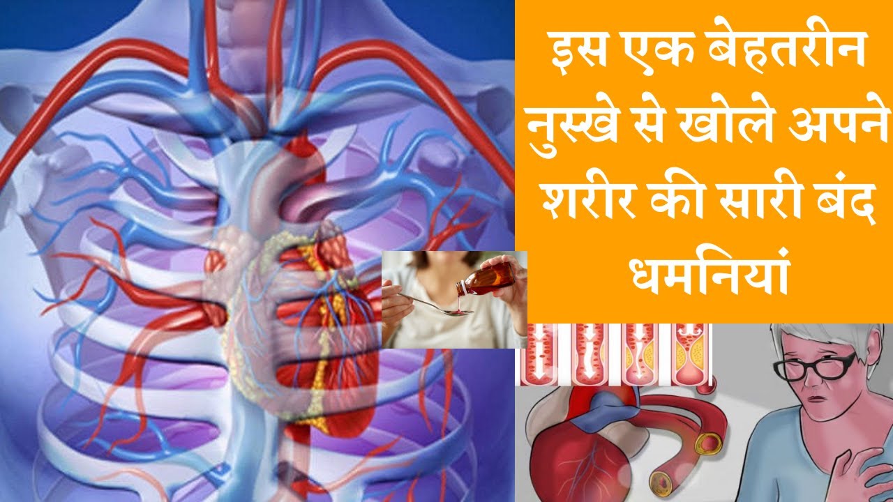 Best ayurvedic syrup to open closed arteries बंद धमनियां खोलने का पक्का नुस्खा