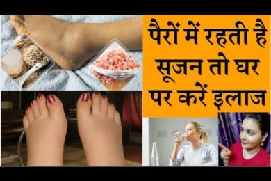 Home remedies to treat swollen feet पैरों में रहती है सूजन तो करें ये इलाज,